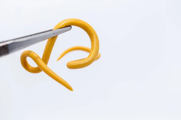 Ascariasis, parazit yuvarlak kurt Ascaris lumbrikoidlerinin laboratuarlarda eğitim için neden olduğu bir hastalıktır..