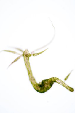 Hydra, Cnidaria cinsi ve Hydrozoa sınıfı eğitim için mikroskop altında bulunan küçük, tatlı su hayvanlarından oluşan bir cinstir..