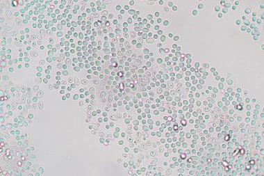 Mikroskop altında gelişen maya hücresi.