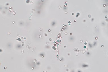 Mikroskop altında gelişen maya hücresi.