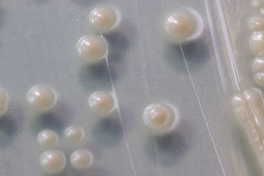 Mikroskop altında gelişen maya hücresi.