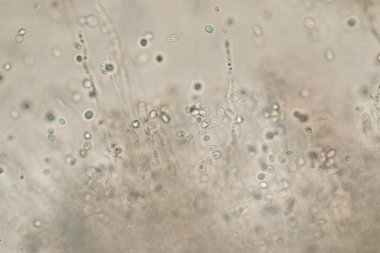 Mikroskop altında gelişen maya hücresi.