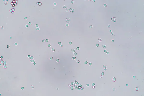 Bimbózó Élesztősejt Mikroszkóp Alatt — Stock Fotó
