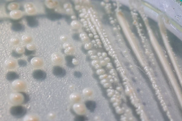 Budding Yeast Cell Microscope — Stock Photo, Image