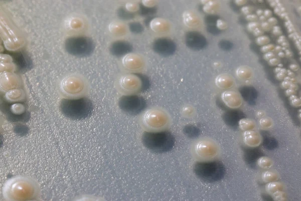 Budding Yeast Cell Microscope — Stock Photo, Image