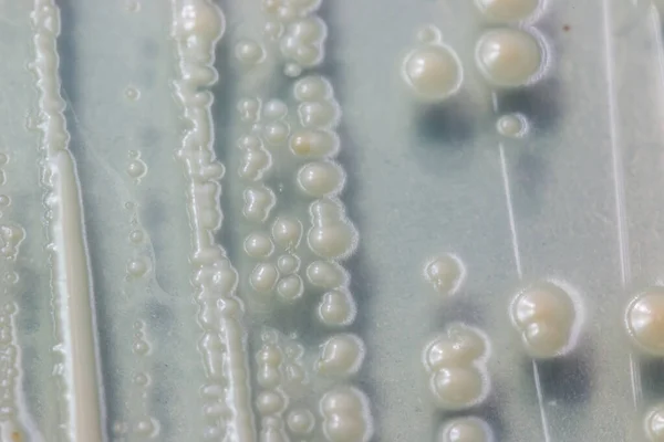 Mikroskop altında gelişen maya hücresi.