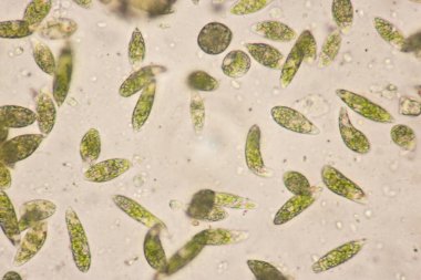 Euglena, mikroskobik eğitim görüşü altında tek hücreli kırbaçlanmış ökaryot cinsidir..