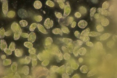 Euglena, mikroskobik eğitim görüşü altında tek hücreli kırbaçlanmış ökaryot cinsidir..