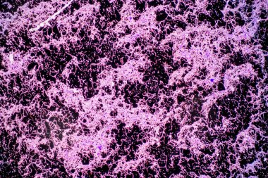 Bacillus, gram-pozitif, çubuk şekilli bakteri cinsi ve bitki örtüsünün bir üyesidir..