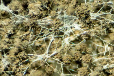 Rhizopus Koloni Özgeçmişi (Ekmek Küfü), mikroskop altında yaygın bir safirik mantar cinsidir..