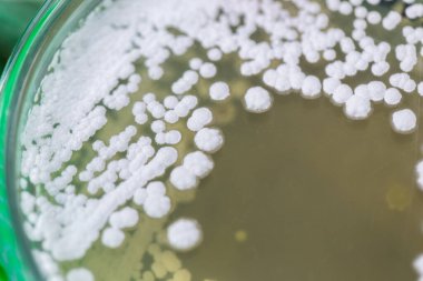 Eğitim için petri kabında bulunan mantar ve alglerin koloni özellikleri.