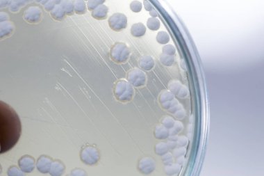 Eğitim için petri kabında bulunan mantar ve alglerin koloni özellikleri.