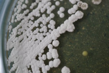 Eğitim için petri kabında bulunan mantar ve alglerin koloni özellikleri.