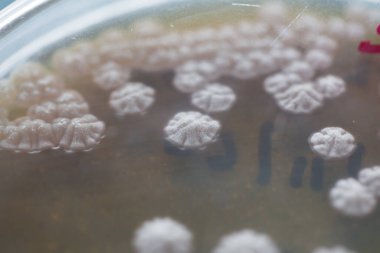 Eğitim için petri kabında bulunan mantar ve alglerin koloni özellikleri.