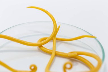 Ascariasis, parazit yuvarlak kurt Ascaris lumbrikoidlerinin laboratuarlarda eğitim için neden olduğu bir hastalıktır..