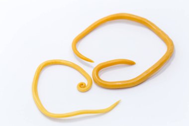 Ascariasis, parazit yuvarlak kurt Ascaris lumbrikoidlerinin laboratuarlarda eğitim için neden olduğu bir hastalıktır..