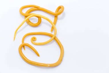 Ascariasis, parazit yuvarlak kurt Ascaris lumbrikoidlerinin laboratuarlarda eğitim için neden olduğu bir hastalıktır..