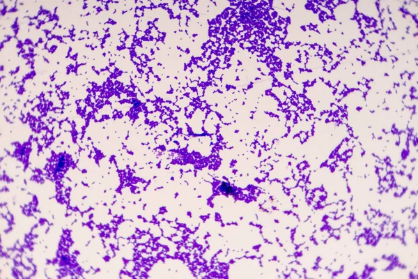 바실루스 Bacillus 모양의 박테리아 하나이며 Phylum Firmicutes — 스톡 사진