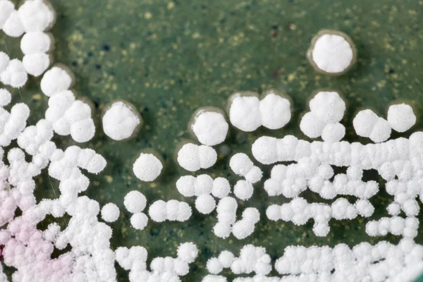 Backgrounds Colony Characteristics Fungus Algae Petri Dish Education — Stock Photo, Image