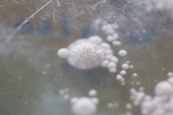 Backgrounds of Colony Characteristics of Fungus and algae in petri dish for education.