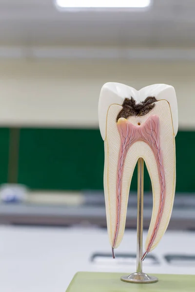 Sınıf Eğitimi Laboratuvar Için Diş Modeli — Stok fotoğraf