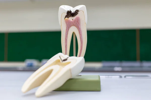 课堂教育和实验室教育的牙齿模型 — 图库照片
