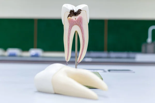 课堂教育和实验室教育的牙齿模型 — 图库照片