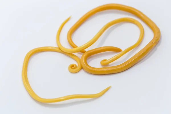 Ascariasis, parazit yuvarlak kurt Ascaris lumbrikoidlerinin laboratuarlarda eğitim için neden olduğu bir hastalıktır..