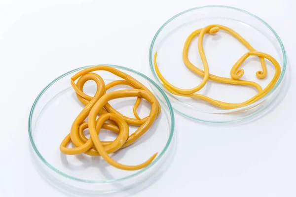 Ascariasis, parazit yuvarlak kurt Ascaris lumbrikoidlerinin laboratuarlarda eğitim için neden olduğu bir hastalıktır..