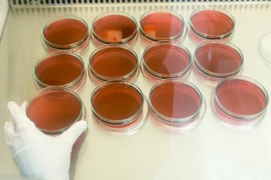Biyolojik güvenlik dolapları laboratuvarında Inoculum testleri için kültür medyumu Eosin Metilen Blue (EMB) Agar.
