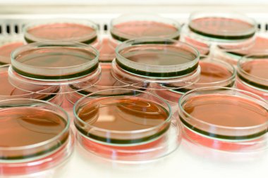 Biyolojik güvenlik dolapları laboratuvarında Inoculum testleri için kültür medyumu Eosin Metilen Blue (EMB) Agar.