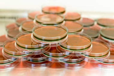 Biyolojik güvenlik dolapları laboratuvarında Inoculum testleri için kültür medyumu Eosin Metilen Blue (EMB) Agar.