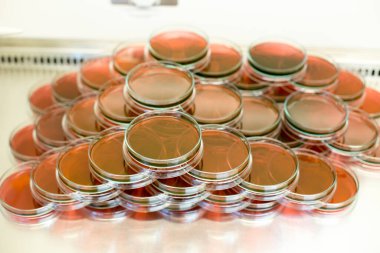 Biyolojik güvenlik dolapları laboratuvarında Inoculum testleri için kültür medyumu Eosin Metilen Blue (EMB) Agar.