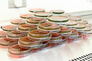 Biyolojik güvenlik dolapları laboratuvarında Inoculum testleri için kültür medyumu Eosin Metilen Blue (EMB) Agar.