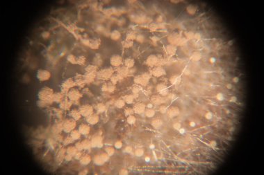 Eğitim için petri kabında Koloni Mantar Özellikleri (Rhizopus) geçmişi.