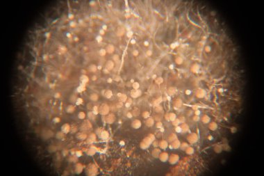 Eğitim için petri kabında Koloni Mantar Özellikleri (Rhizopus) geçmişi.