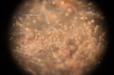 Eğitim için petri kabında Koloni Mantar Özellikleri (Rhizopus) geçmişi.