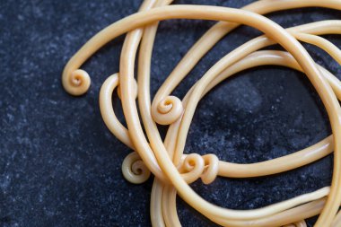 Ascariasis, parazit yuvarlak kurt Ascaris lumbrikoidlerinin laboratuarlarda eğitim için neden olduğu bir hastalıktır..