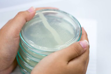 Laboratuvarda iyotla enfeksiyon mikrobiyolojisi test ediliyor..