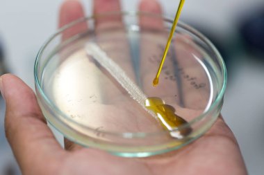 Laboratuvarda iyotla enfeksiyon mikrobiyolojisi test ediliyor..