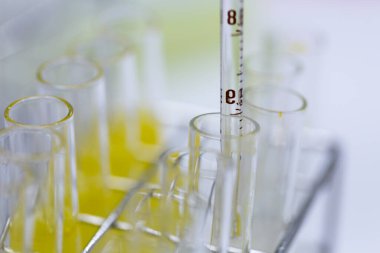 Polimeraz zincir reaksiyonu (PCR) ve Agarose gel elektroforezi laboratuvarda biyokimya, moleküler biyoloji, genetik ve klinik kimyada kullanılan bir jel elektroforez metodudur..