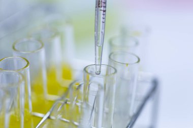 Polimeraz zincir reaksiyonu (PCR) ve Agarose gel elektroforezi laboratuvarda biyokimya, moleküler biyoloji, genetik ve klinik kimyada kullanılan bir jel elektroforez metodudur..