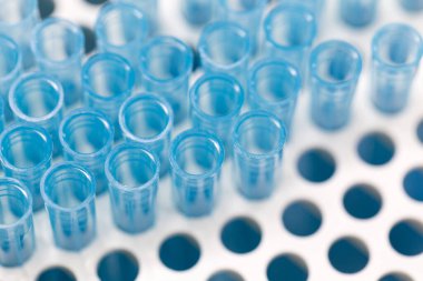 Polimeraz zincir reaksiyonu (PCR) ve Agarose gel elektroforezi laboratuvarda biyokimya, moleküler biyoloji, genetik ve klinik kimyada kullanılan bir jel elektroforez metodudur..