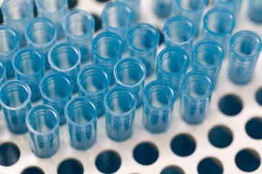 Polimeraz zincir reaksiyonu (PCR) ve Agarose gel elektroforezi laboratuvarda biyokimya, moleküler biyoloji, genetik ve klinik kimyada kullanılan bir jel elektroforez metodudur..