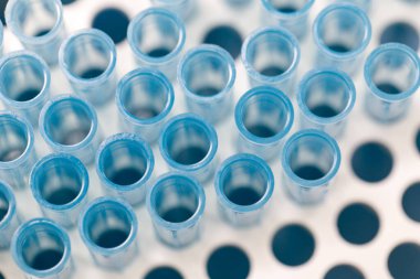 Polimeraz zincir reaksiyonu (PCR) ve Agarose gel elektroforezi laboratuvarda biyokimya, moleküler biyoloji, genetik ve klinik kimyada kullanılan bir jel elektroforez metodudur..
