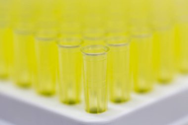 Polimeraz zincir reaksiyonu (PCR) ve Agarose gel elektroforezi laboratuvarda biyokimya, moleküler biyoloji, genetik ve klinik kimyada kullanılan bir jel elektroforez metodudur..