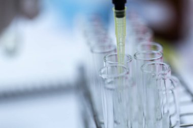 Polimeraz zincir reaksiyonu (PCR) ve Agarose gel elektroforezi laboratuvarda biyokimya, moleküler biyoloji, genetik ve klinik kimyada kullanılan bir jel elektroforez metodudur..