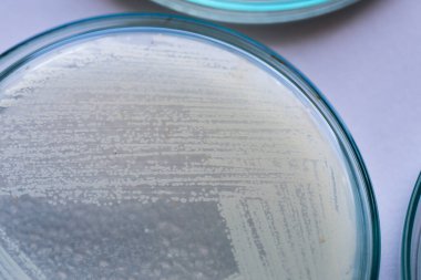 Petri kabında maya, laboratuvarlarda eğitim için mikrobiyoloji.