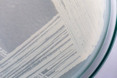 Petri kabında maya, laboratuvarlarda eğitim için mikrobiyoloji.