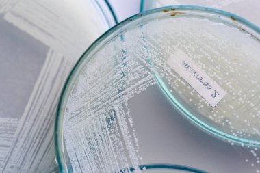 Petri kabında maya, laboratuvarlarda eğitim için mikrobiyoloji.